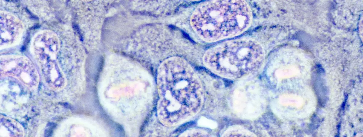 Cell culture HeLa cells - anaphase metaphase