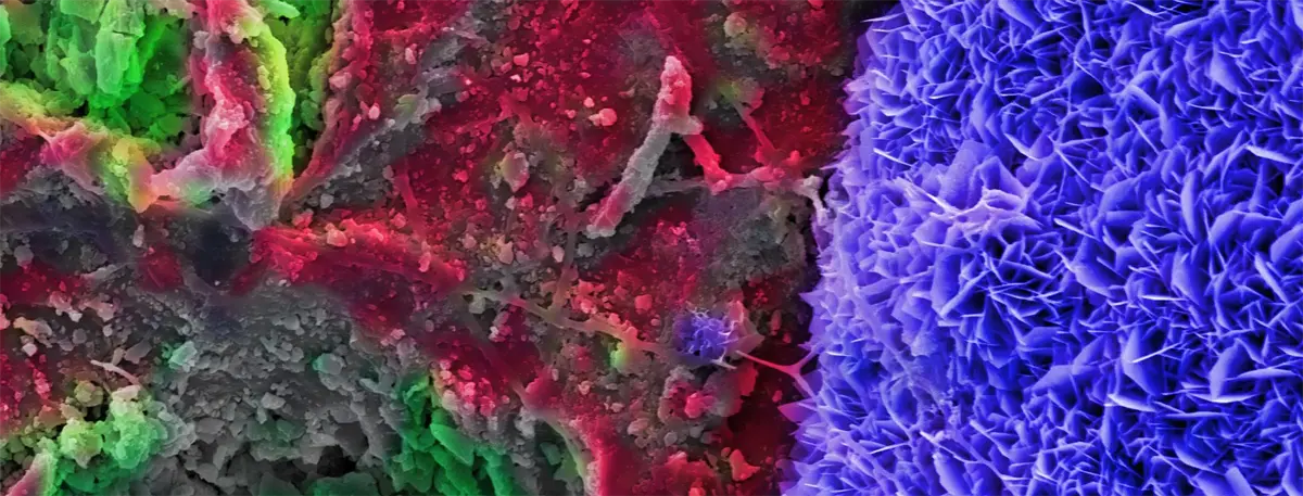 Growing razors inorganic layer growing on biomaterial
